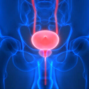Prostate Cancer Symptoms